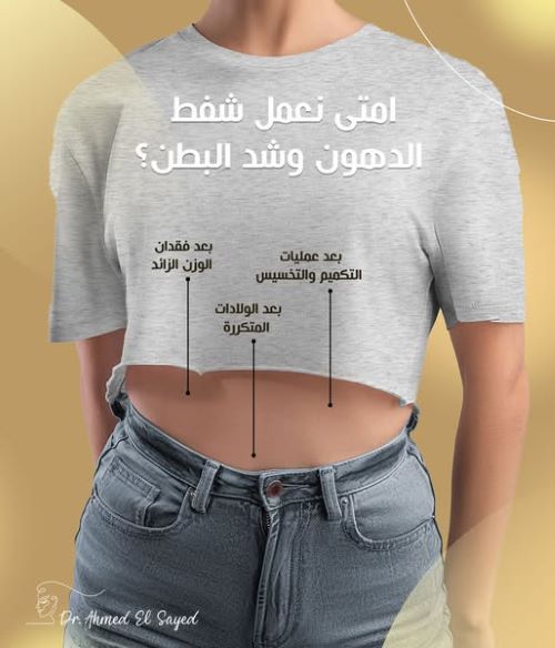 من يحتاج إلى عملية شفط البطن؟